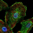 Immunofluorescent staining of human cell line A549 shows localization to plasma membrane & actin filaments.