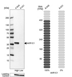 Anti-AKR1C1 Antibody