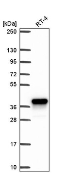 Western blot analysis in human cell line RT-4.