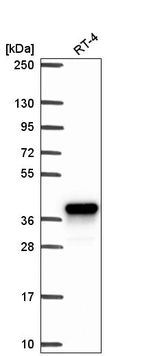 Western blot analysis in human cell line RT-4.