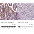 Anti-SLC22A18AS Antibody