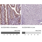 Anti-SLC22A18AS Antibody