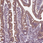 Immunohistochemical staining of human duodenum shows high expression.