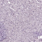 Anti-SLC22A18AS Antibody