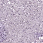 Immunohistochemical staining of human liver shows low expression as expected.