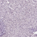Immunohistochemical staining of human liver shows low expression as expected.