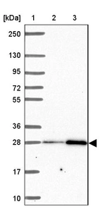 Lane 1: Marker [kDa] 250, 130, 95, 72, 55, 36, 28, 17, 10_br/_Lane 2: Human cell line RT-4_br/_Lane 3: Human cell line U-251 MG