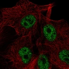 Immunofluorescent staining of human cell line SK-MEL-30 shows localization to nucleoplasm.