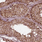 Immunohistochemical staining of human testis shows strong granular cytoplasmic positivity in cells in seminiferous ducts.