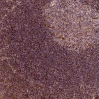Immunohistochemical staining of human tonsil shows strong granular cytoplasmic positivity in non-germinal center cells.