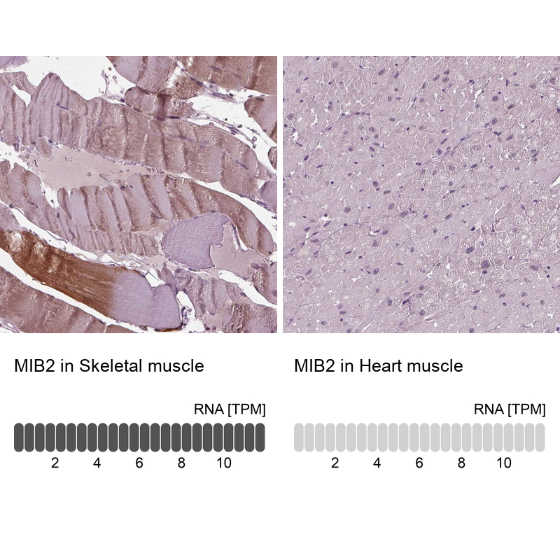 Anti-MIB2 Antibody