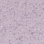 Immunohistochemical staining of human heart muscle shows low expression as expected.
