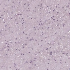 Immunohistochemical staining of human heart muscle shows low expression as expected.