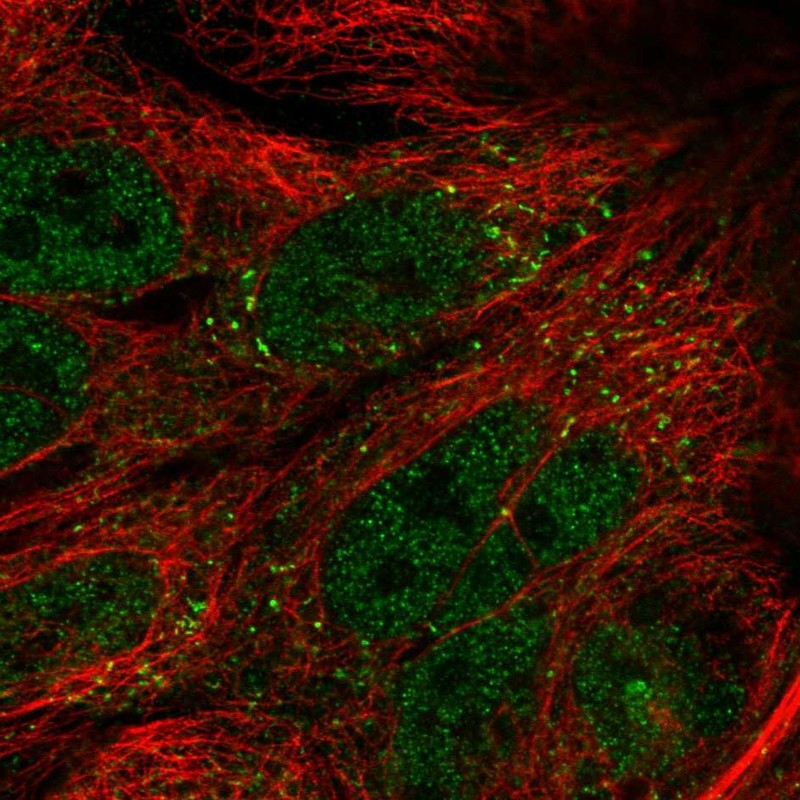 Anti-TTI1 Antibody