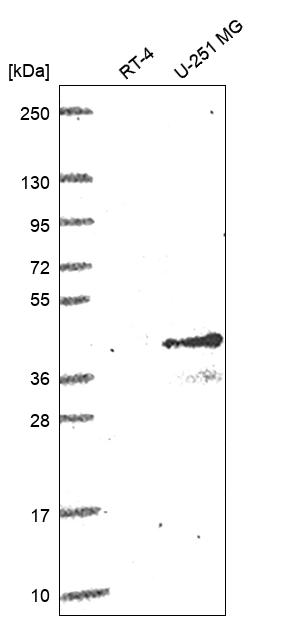 Anti-CD1C Antibody