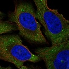 Immunofluorescent staining of human cell line U-2 OS shows localization to cytosol & cytoplasmic bodies.