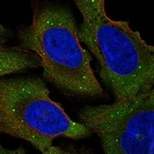 Immunofluorescent staining of human cell line U-2 OS shows localization to cytosol & cytoplasmic bodies.