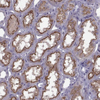 Anti-CACNA1F Antibody