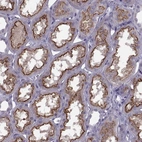 Immunohistochemical staining of human kidney shows strong membranous positivity in cells in tubules.