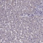 Anti-CACNA1F Antibody