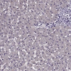 Immunohistochemical staining of human liver shows negative positivity in hepatocytes as expected.