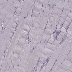 Immunohistochemical staining of human skeletal muscle shows negative positivity in myocytes as expected.