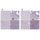 Immunohistochemical staining of human cerebral cortex, fallopian tube, liver and spleen using Anti-CD5L antibody HPA068384 (A) shows similar protein distribution across tissues to independent antibody HPA065686 (B).