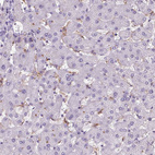 Immunohistochemical staining of human liver shows moderate cytoplasmic positivity in Kupffer cells.