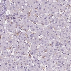 Immunohistochemical staining of human liver shows moderate cytoplasmic positivity in Kupffer cells.