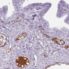 Immunohistochemical staining of human fallopian tube shows moderate positivity in plasma in blood vessels.
