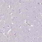 Immunohistochemical staining of human cerebral cortex shows no cytoplasmic positivity in neurons as expected.