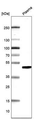 Western blot analysis in human plasma.