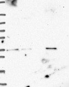 Anti-ETV1 Antibody