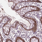 Immunohistochemical staining of human colon shows moderate to strong nuclear positivity in glandular cells.