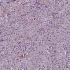 Immunohistochemical staining of human pancreas shows no positivity in exocrine glandular cells as expected.