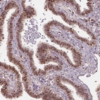 Immunohistochemical staining of human fallopian tube shows strong nuclear positivity in glandular cells.