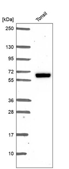 Anti-ESR2 Antibody