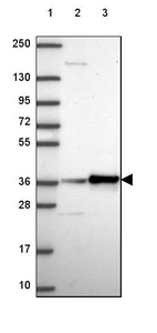 Lane 1: Marker [kDa] 250, 130, 95, 72, 55, 36, 28, 17, 10_br/_Lane 2: Human cell line RT-4_br/_Lane 3: Human cell line U-251 MG