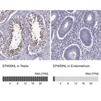 Anti-EP400NL Antibody