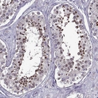 Immunohistochemical staining of human testis shows high expression.
