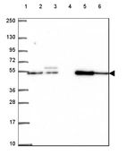 Lane 1: Marker [kDa] 250, 130, 95, 72, 55, 36, 28, 17, 10_br/_Lane 2: Human cell line RT-4_br/_Lane 3: Human cell line U-251 MG_br/_Lane 4: Human plasma_br/_Lane 5: Human Liver tissue_br/_Lane 6: Human Tonsil tissue