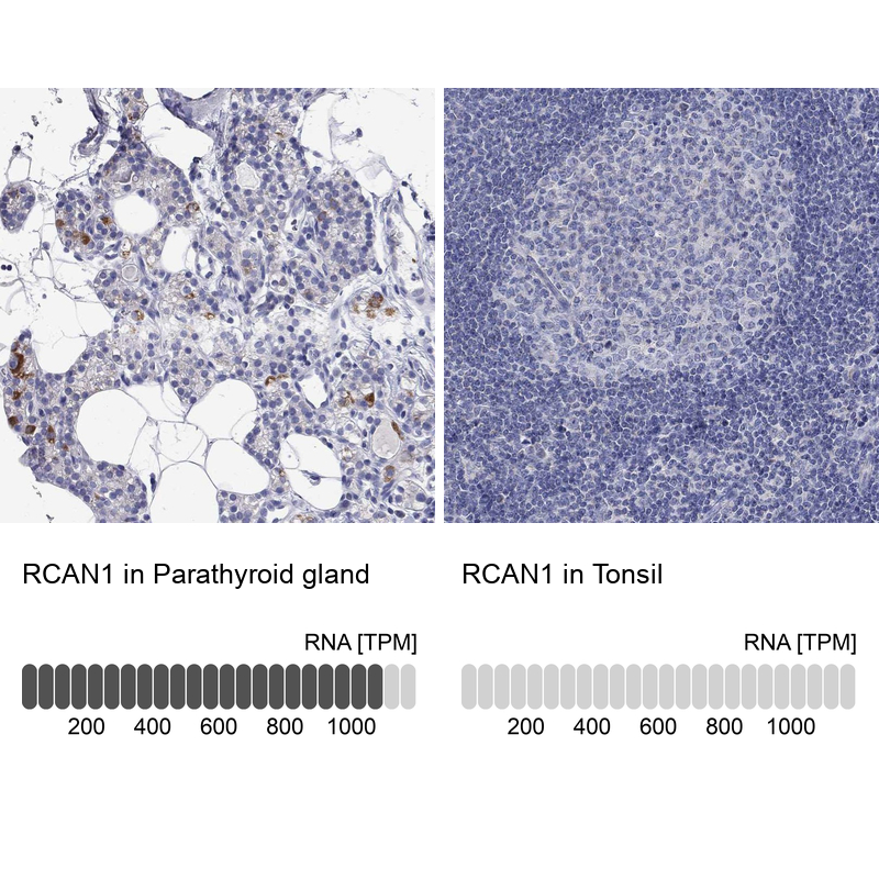Anti-RCAN1 Antibody