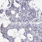 Immunohistochemical staining of human parathyroid gland shows high expression.