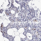 Immunohistochemical staining of human parathyroid gland shows high expression.