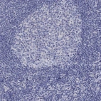 Immunohistochemical staining of human tonsil shows low expression as expected.