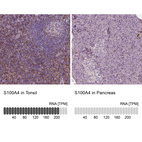 Anti-S100A4 Antibody