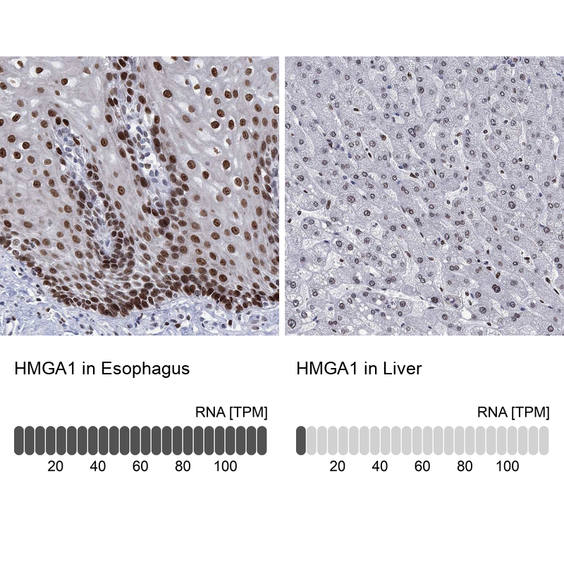 Anti-HMGA1 Antibody