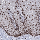 Immunohistochemical staining of human esophagus shows high expression.