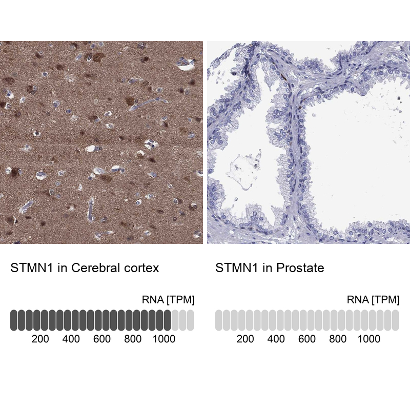 Anti-STMN1 Antibody