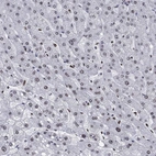 Immunohistochemical staining of human liver shows low expression as expected.